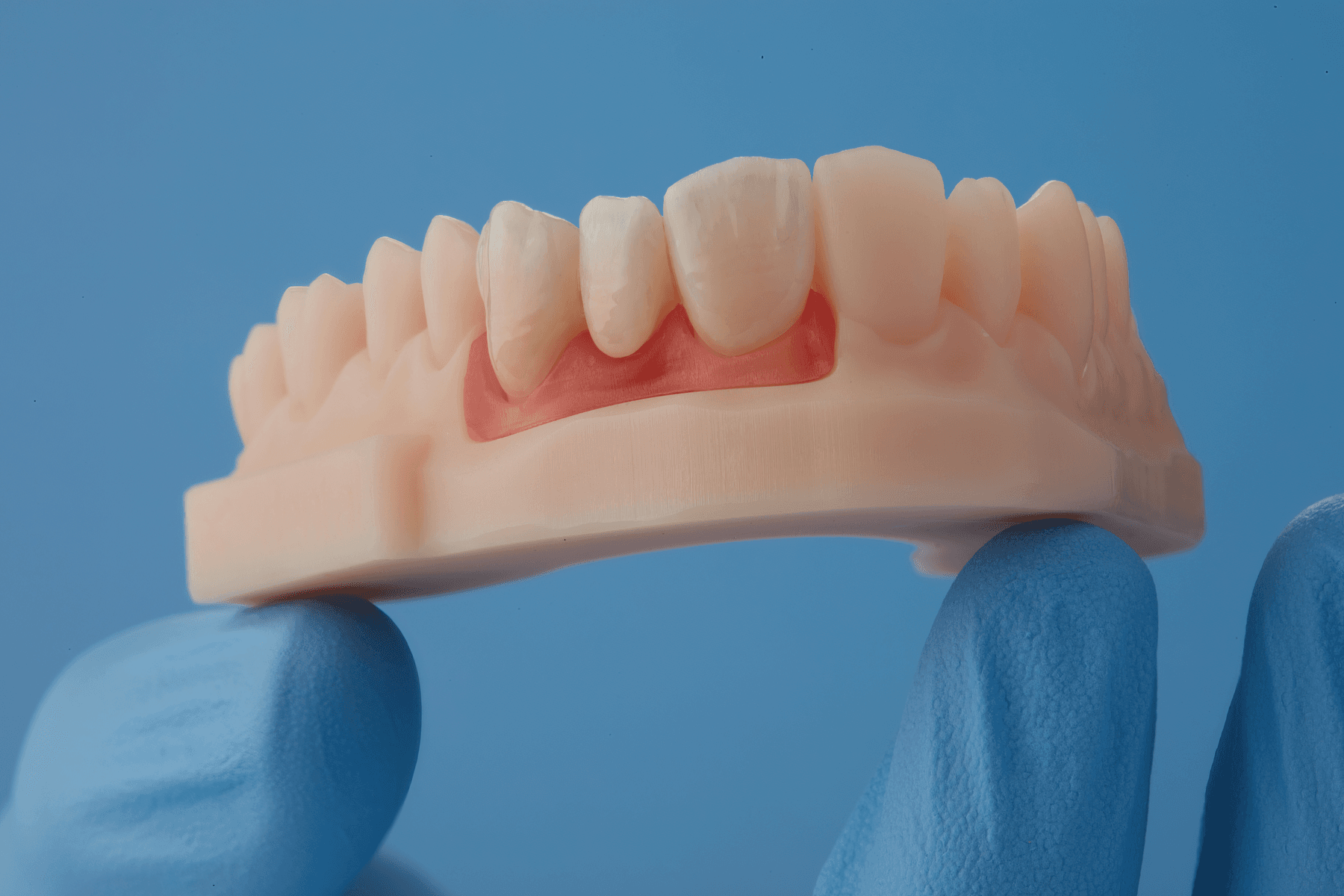 Weichgewebe mit Dentalmodellen