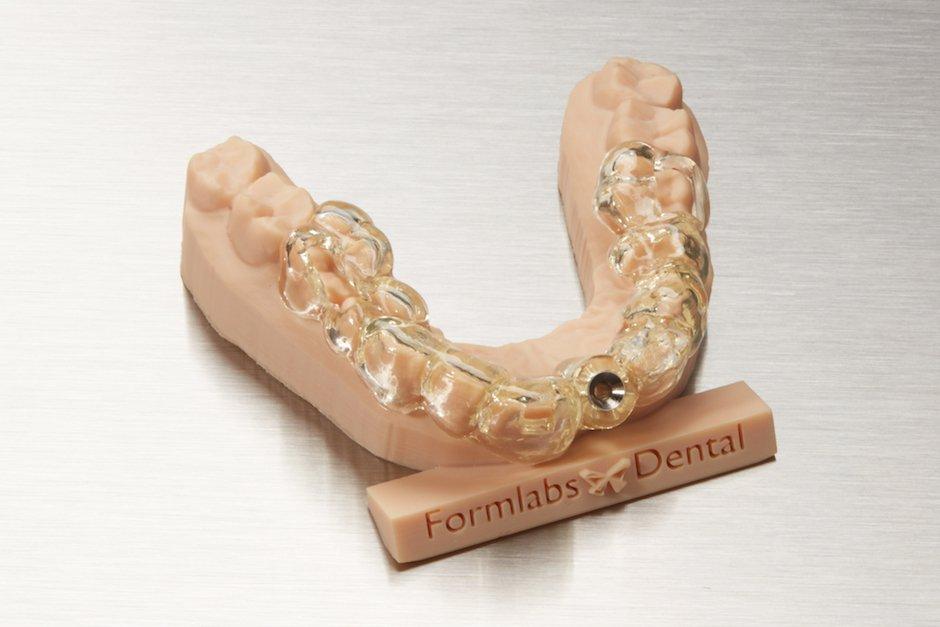 Dental Model